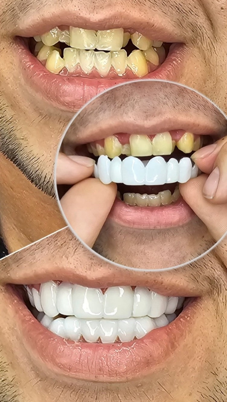 🦷¿Sueñas con una sonrisa blanca y perfecta? Este es tu momento.🦷