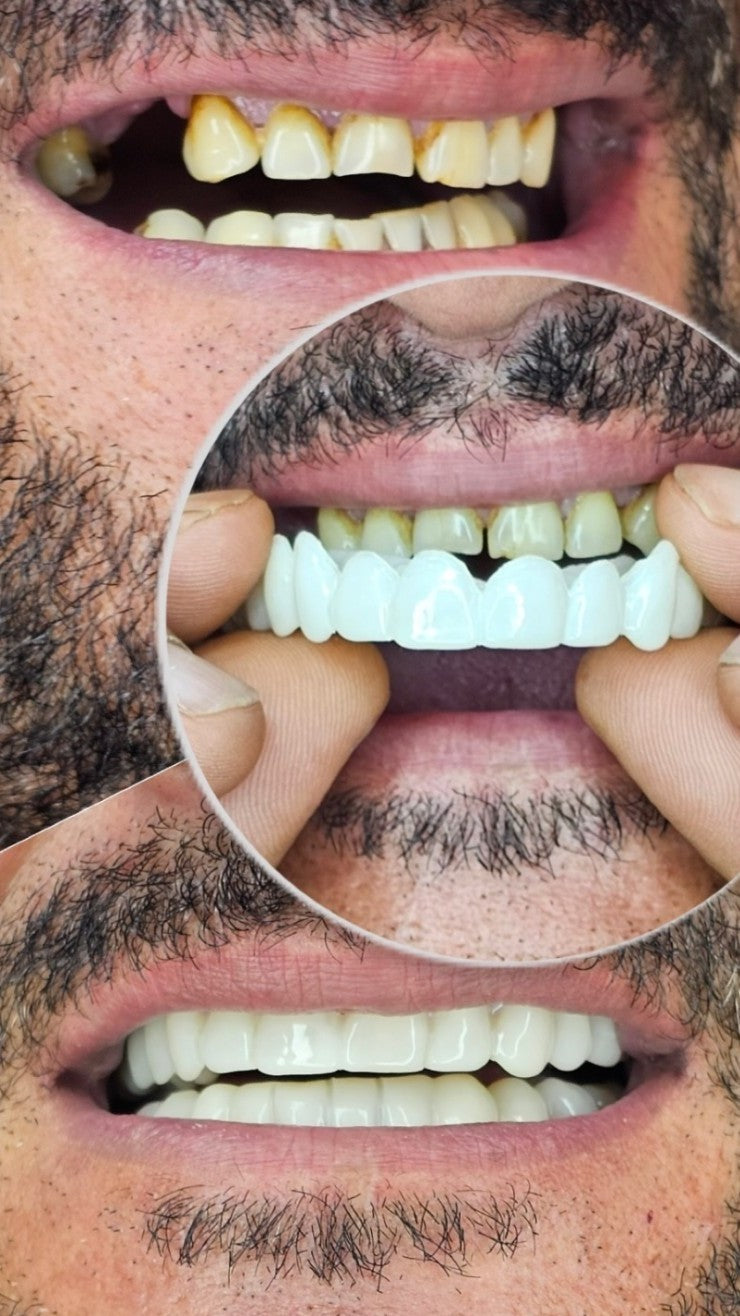 🦷¿Sueñas con una sonrisa blanca y perfecta? Este es tu momento.🦷