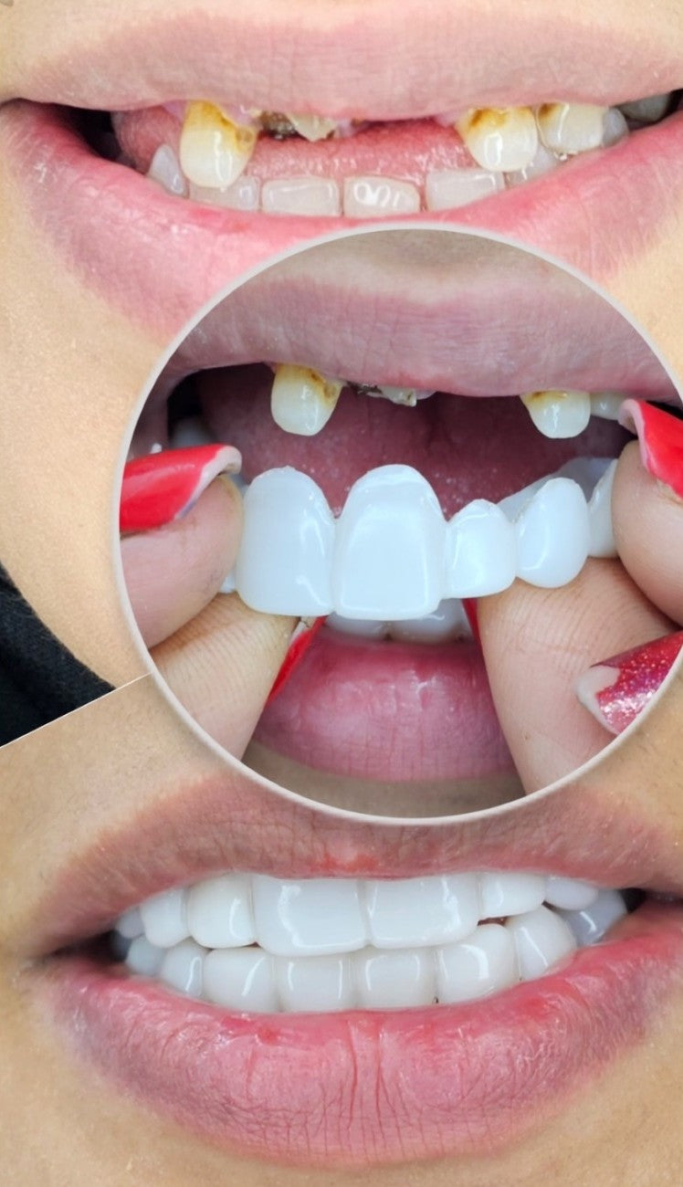 🦷¿Sueñas con una sonrisa blanca y perfecta? Este es tu momento.🦷