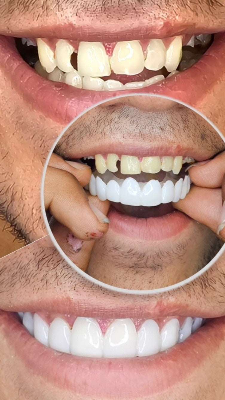 🦷¿Sueñas con una sonrisa blanca y perfecta? Este es tu momento.🦷