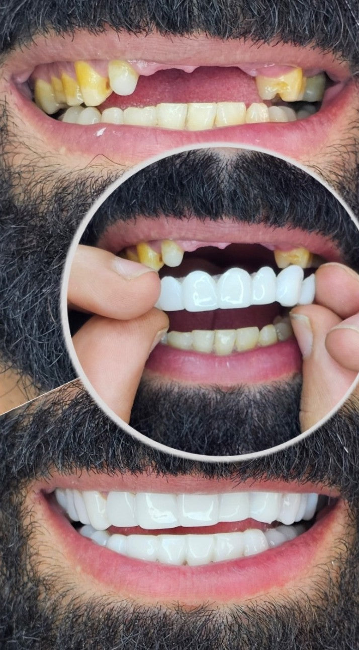 🦷¿Sueñas con una sonrisa blanca y perfecta? Este es tu momento.🦷